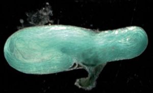 אחד המבנים המשמש את נקבות הצדפוניות ככלי-קיבול לזרעונים. אפשר להבחין בזרעונים בתוך המבנה.