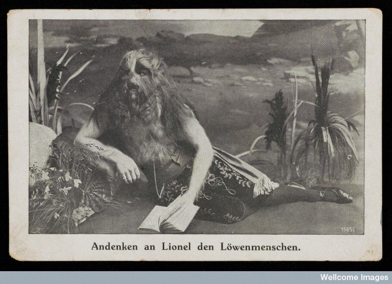 גלויה המציגה את ליונל, הילד בעל פני האריה