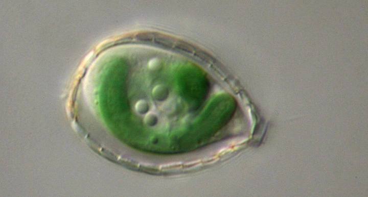 פוֹלינלה כרומטופורה וה